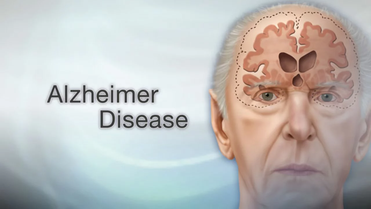 The Role of Diet and Exercise in Preventing Alzheimer's Disease